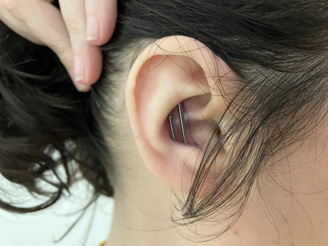 vertical conch piercing