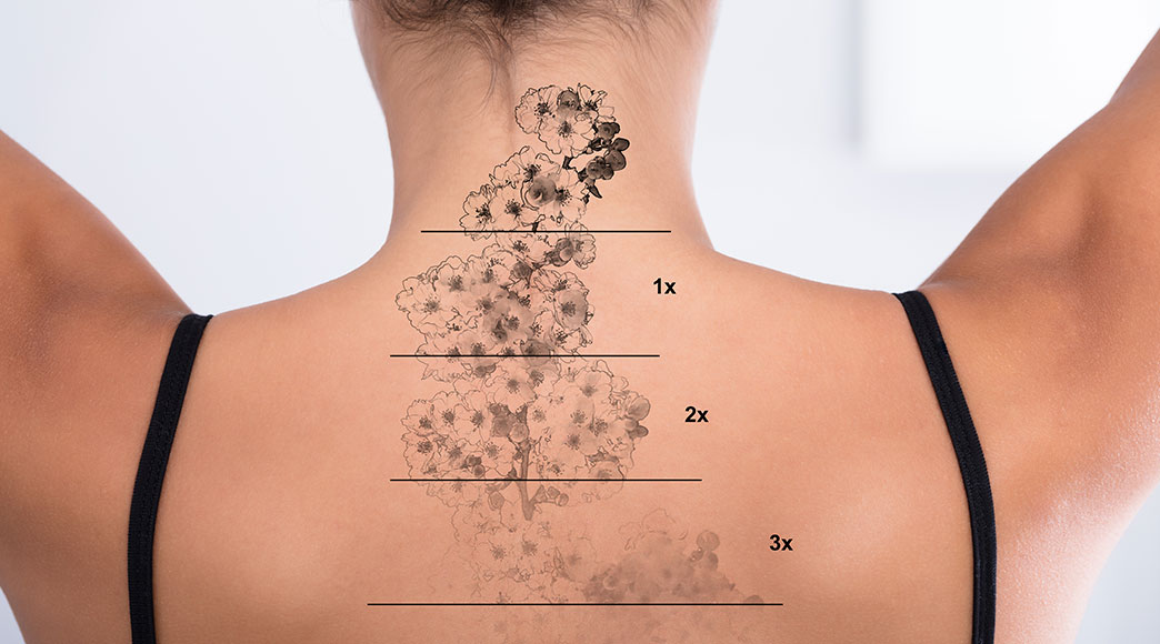 tattoo fading causes