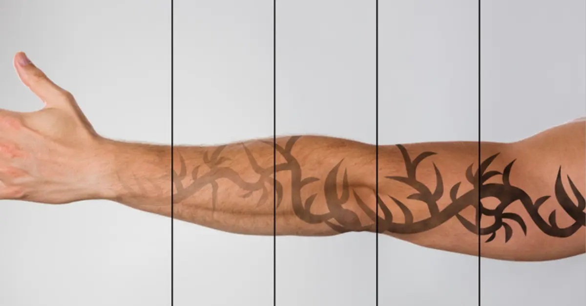 tattoo fading causes