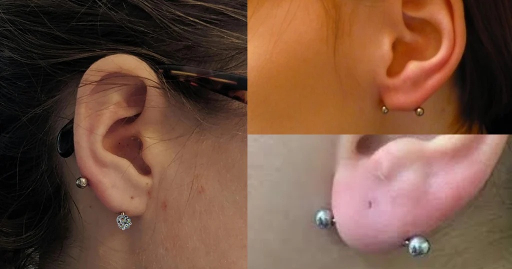 transverse lobe