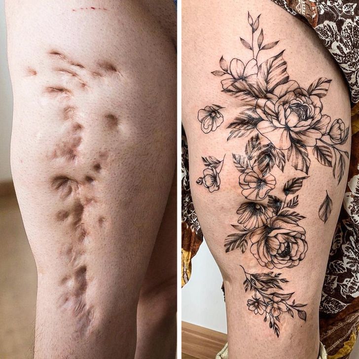 Tattooing on Damaged Skin