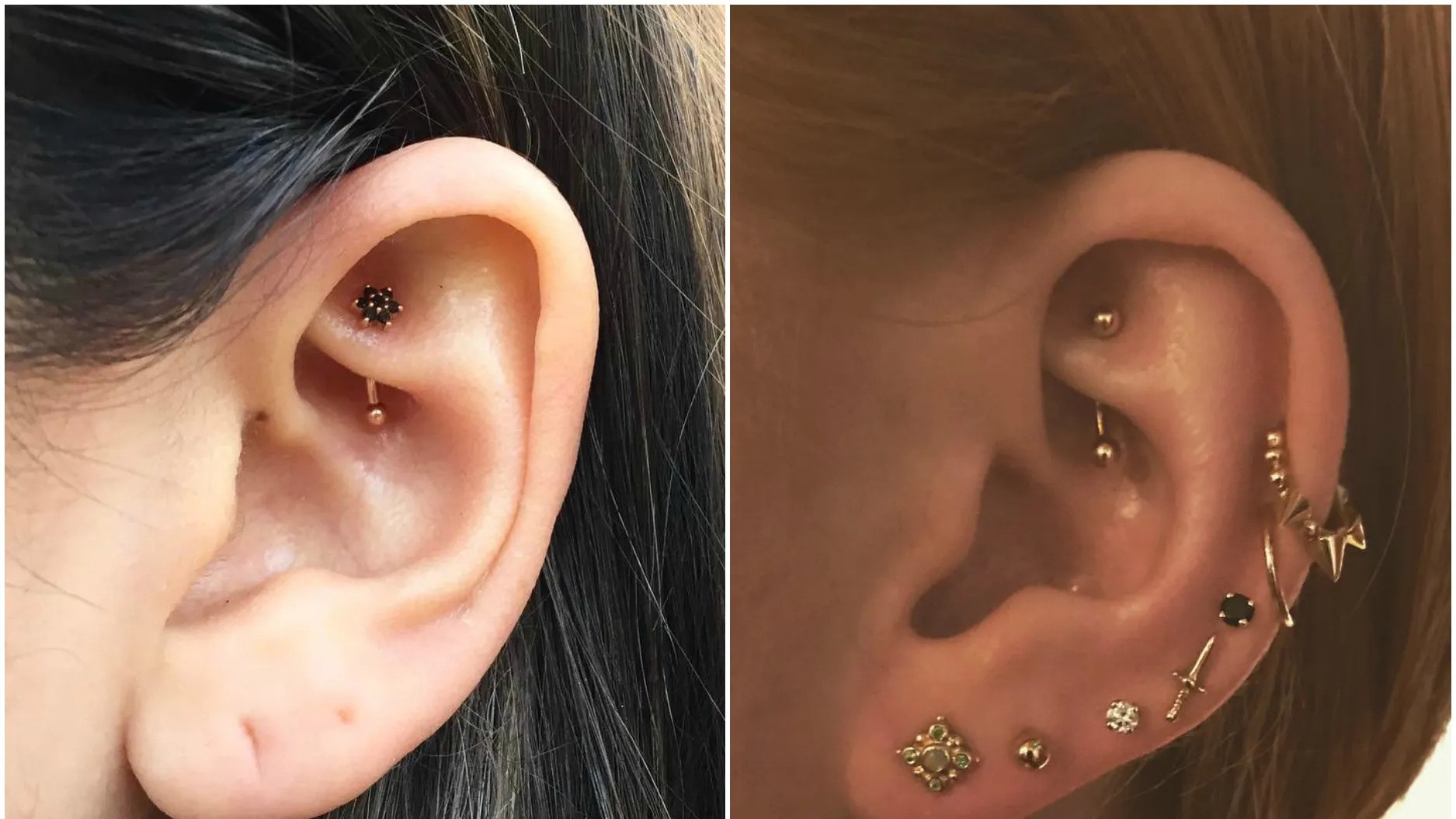 surface tragus