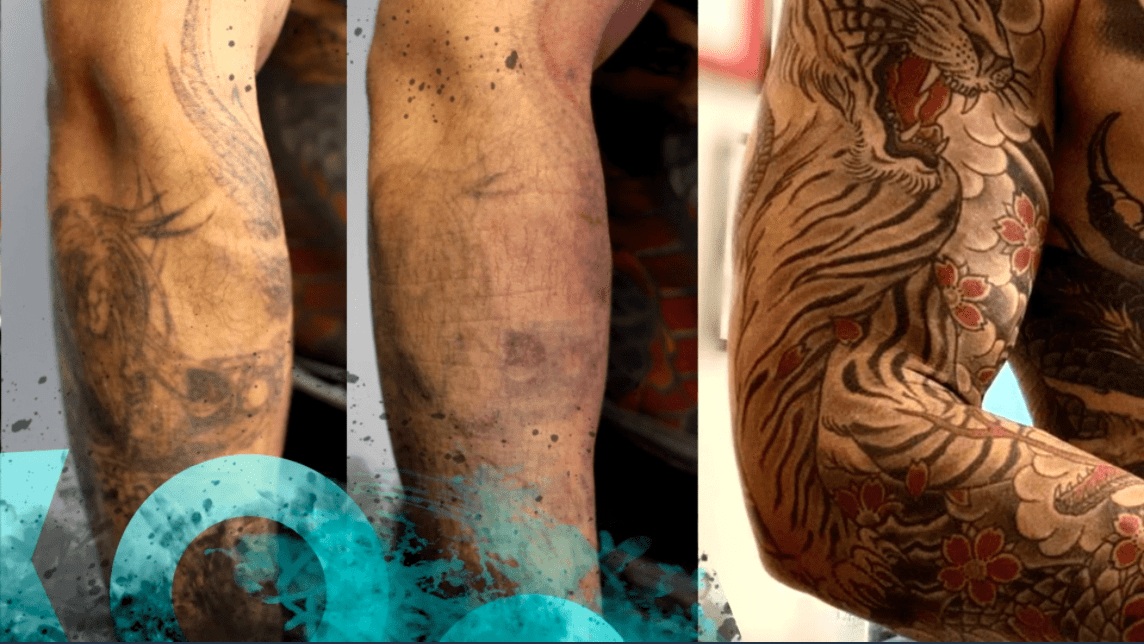 tattoo fading causes