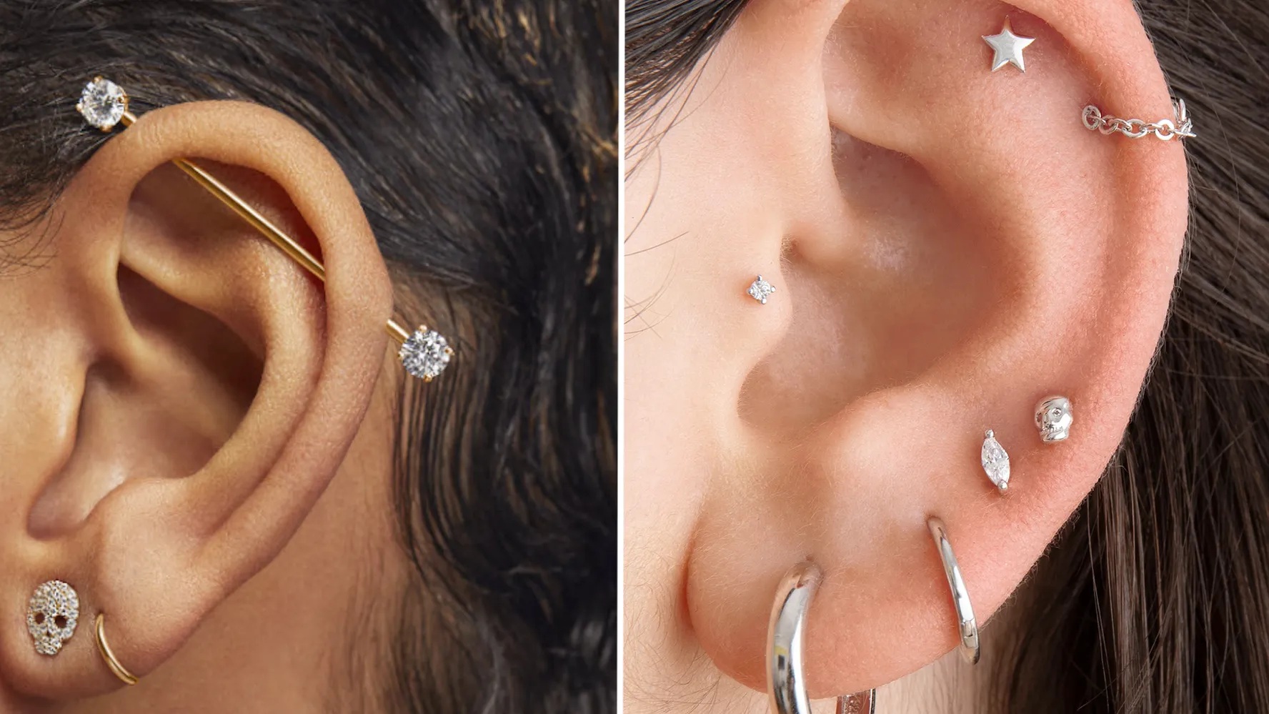 transverse lobe
