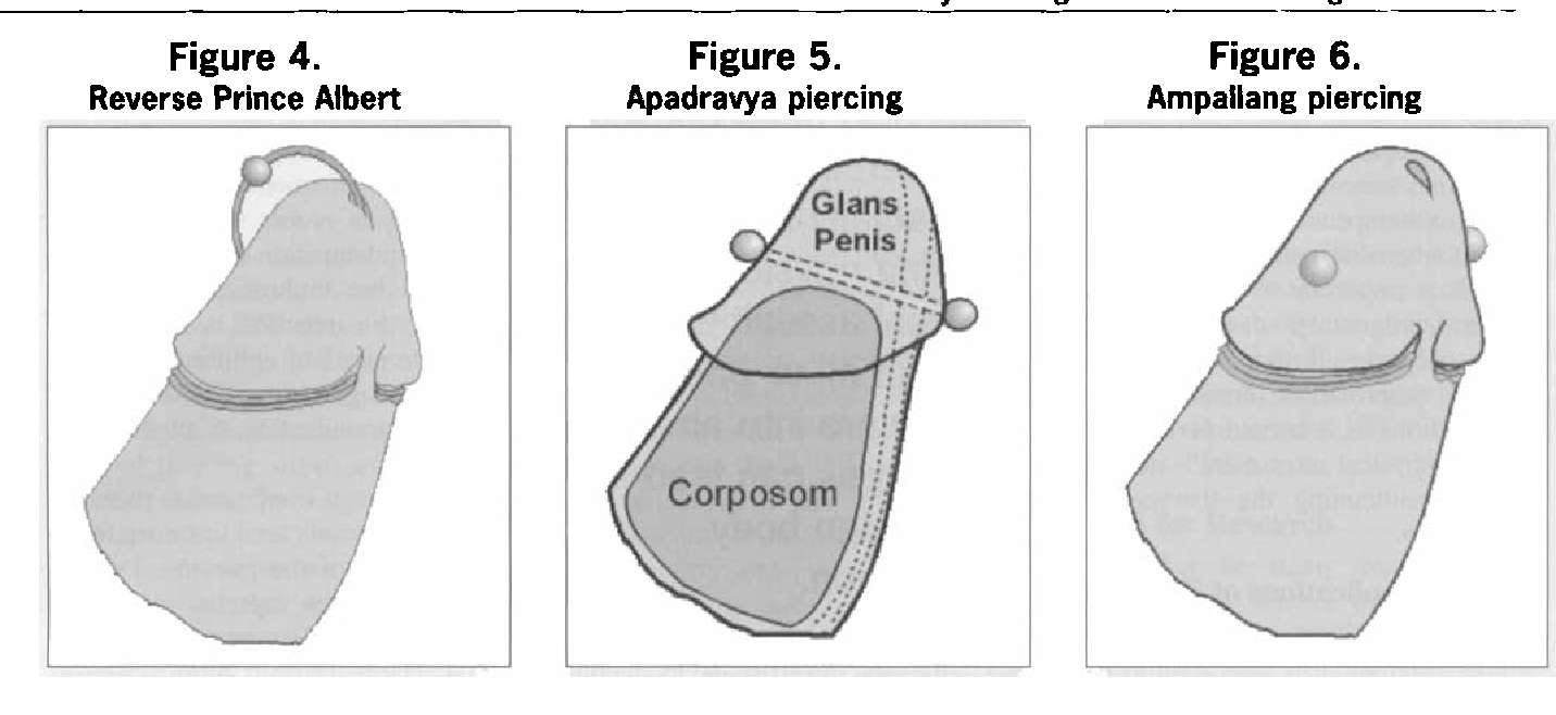 Apadravya piercing