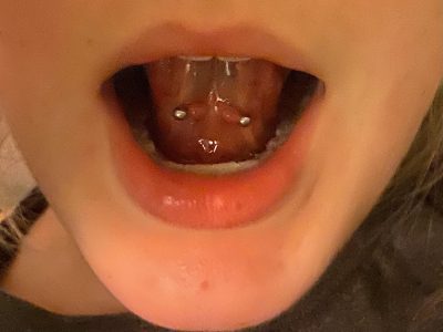 tongue web piercing
