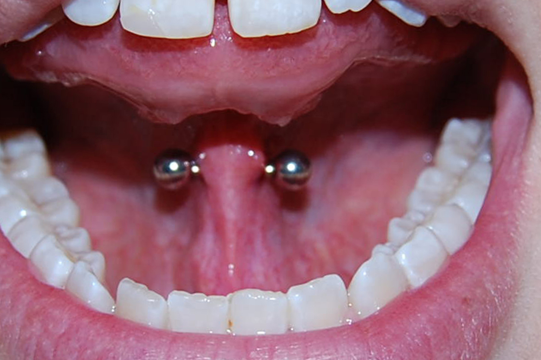 tongue web piercing