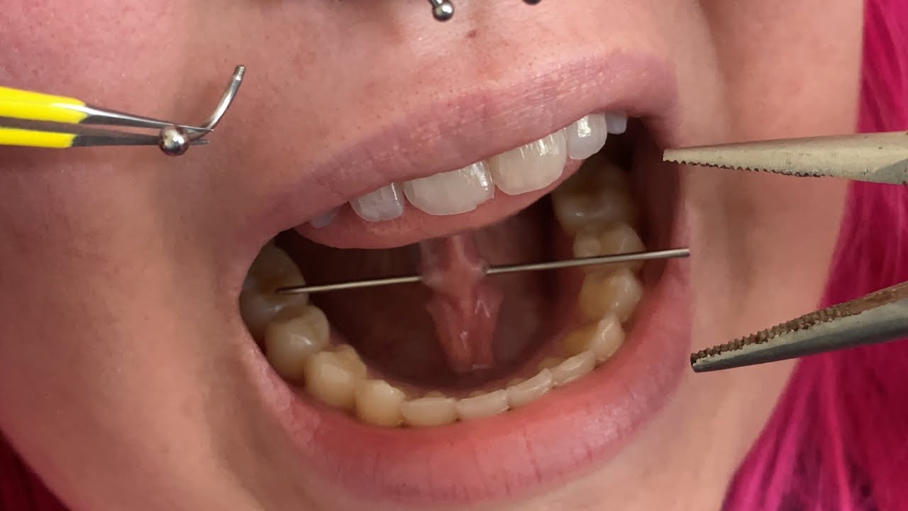 tongue web piercing